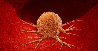 Lewat Sel Imun Yang Disamarkan, Ilmuwan Dapat Cara Baru Berantas Tumor