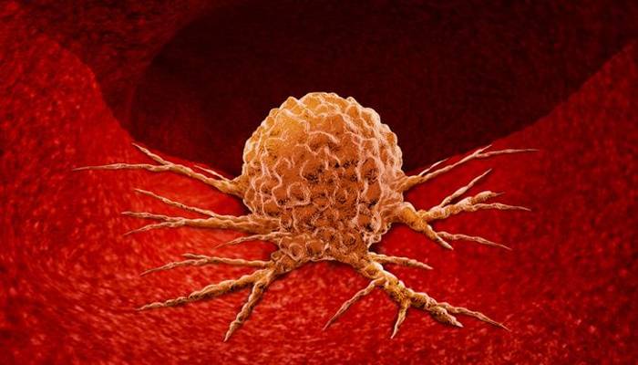 Lewat Sel Imun Yang Disamarkan, Ilmuwan Dapat Cara Baru Berantas Tumor